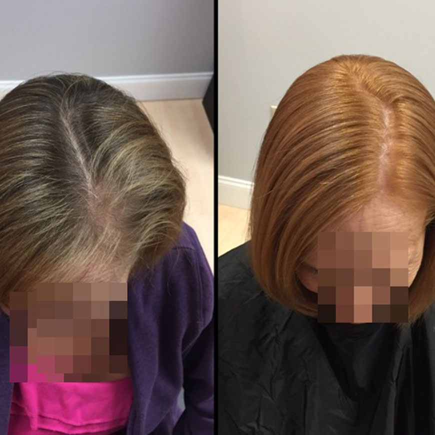 EMG Salons Before and After Photos